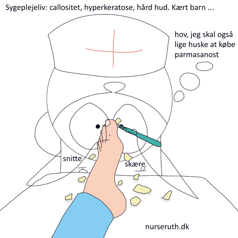 Read more about the article Hyperkeratose